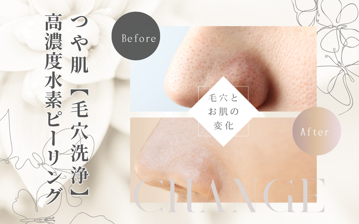 くすみ、角栓詰まりに効果的 | 東京都練馬区｜エステサロンPeau Belle poe
