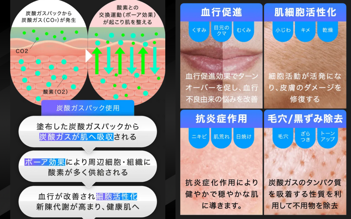 ダウンロード