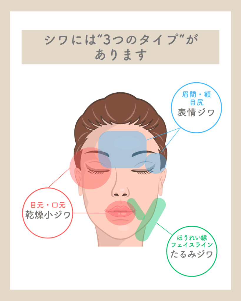 ダウンロード