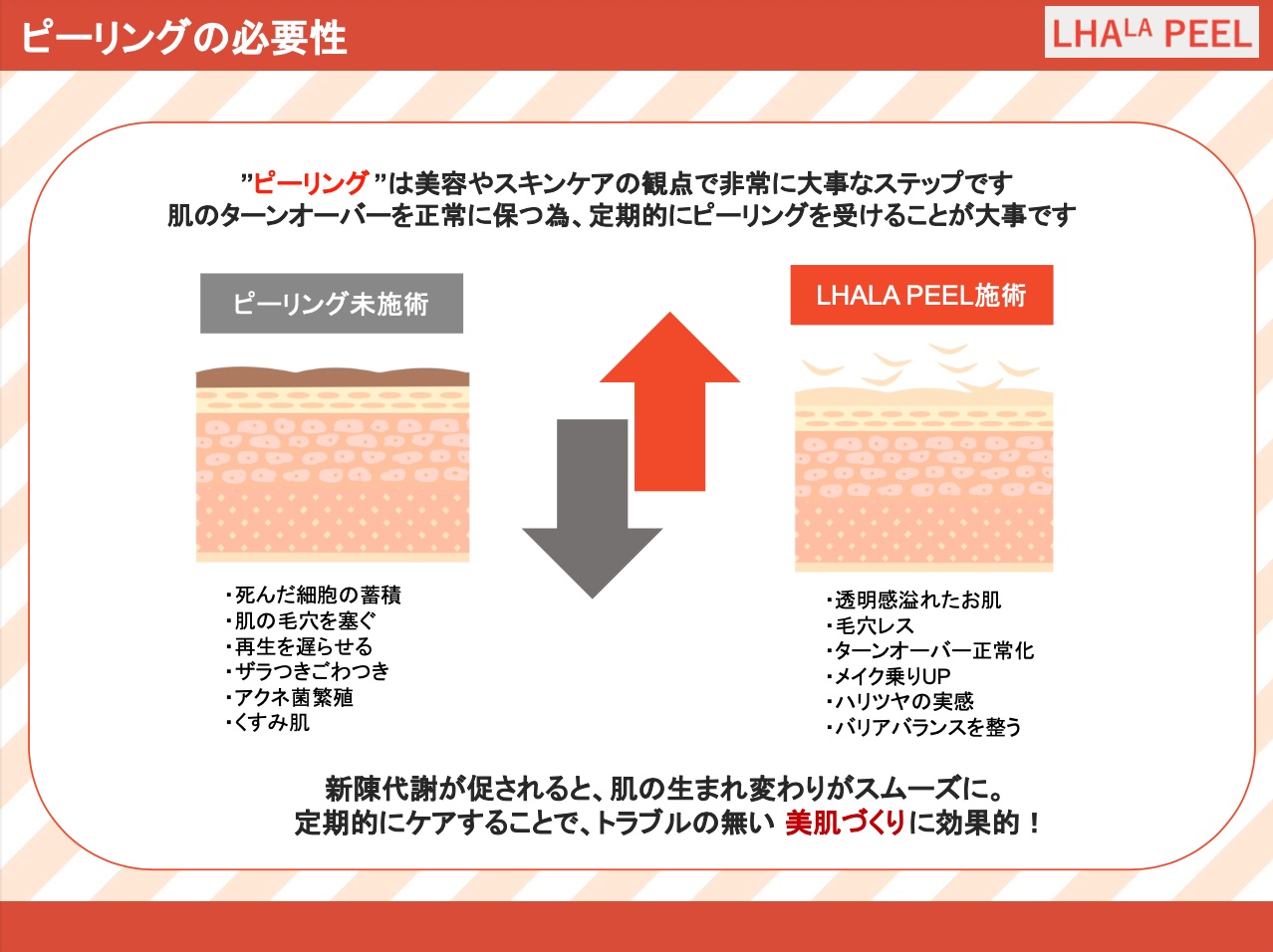 ダウンロード