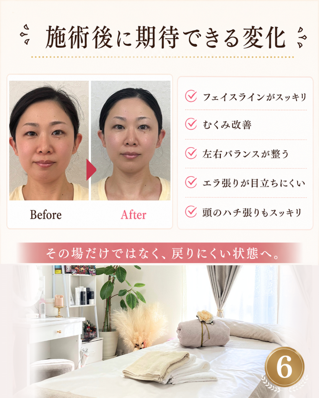 ダウンロード