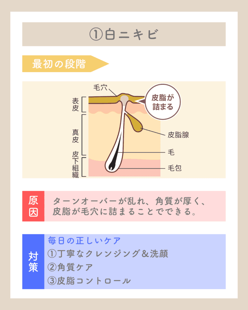 ダウンロード