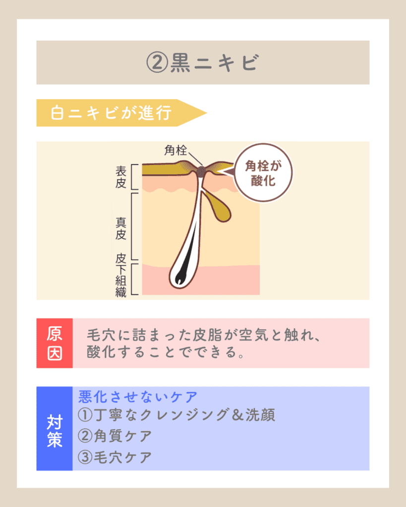 ダウンロード