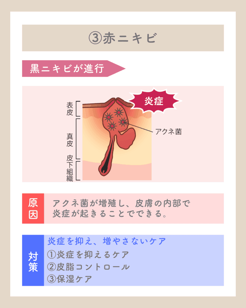 ダウンロード